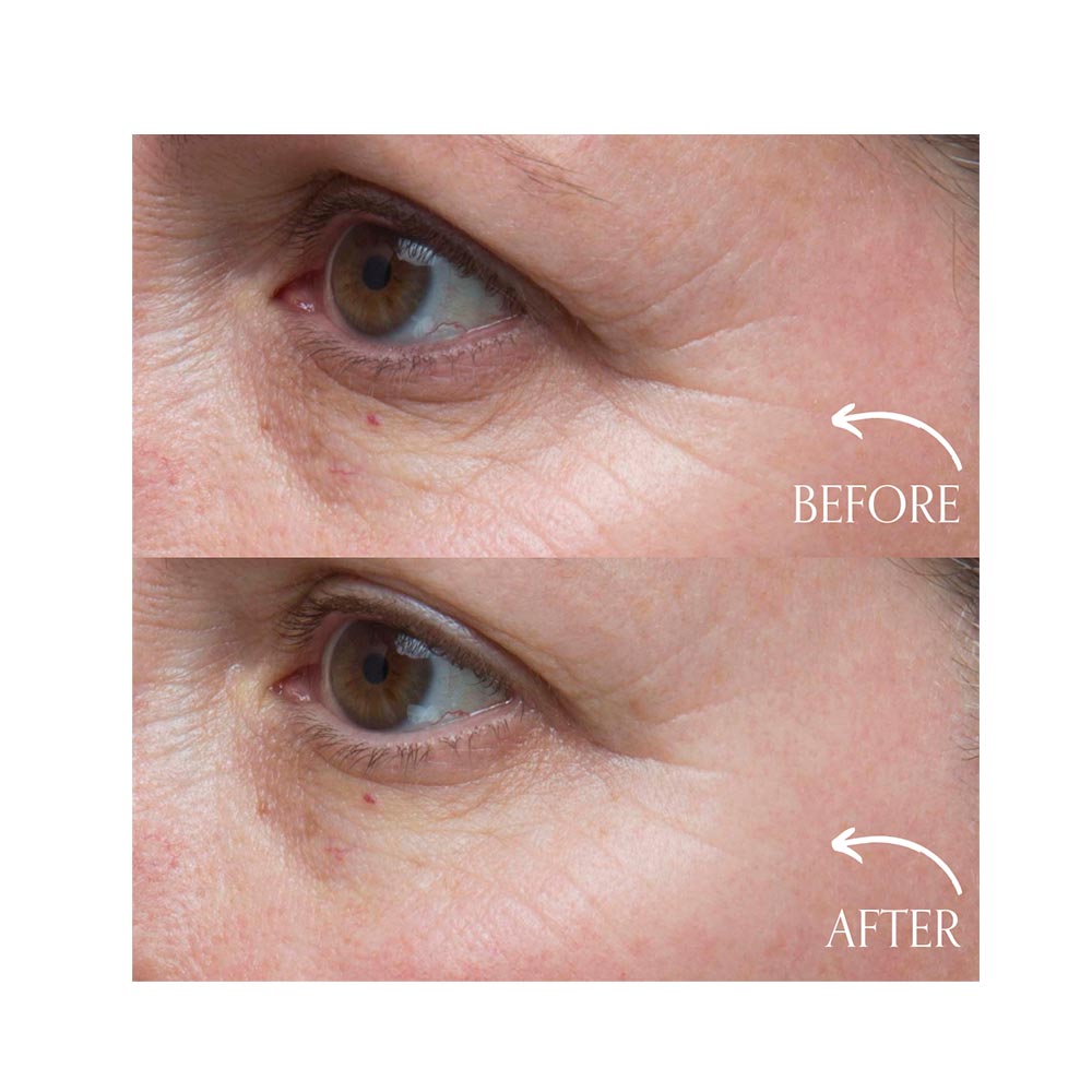 Advanced Youth Infusion Serum